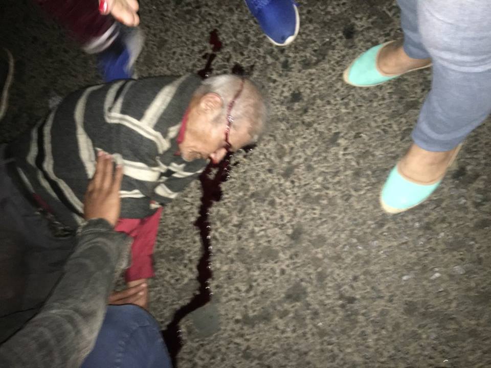 Anciano muere tras ser atropella por un conductor imprudente