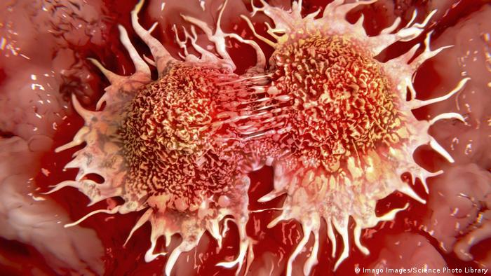 Estudio de fármaco contra el cáncer rectal concluye con la remisión de todos los pacientes