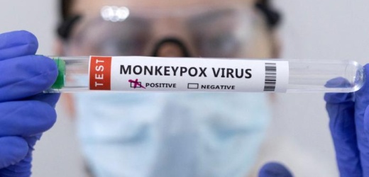 AMÉRICA LATINA Perú acumula más de 1.000 casos de viruela del mono
