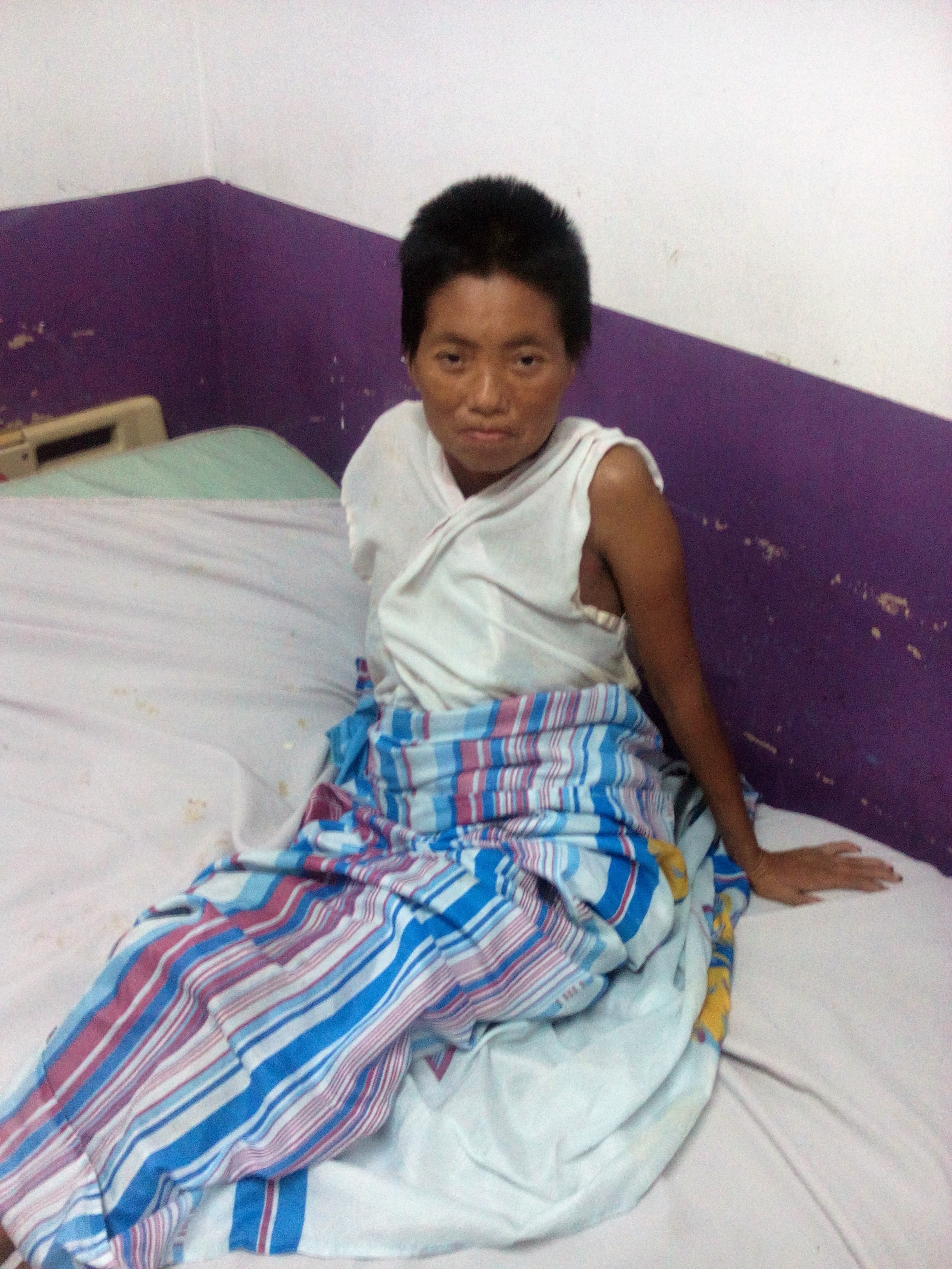 Paciente Metapaneca está abandonado en Hospital Nacional “Arturo Morales”