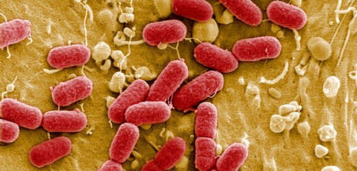 La “pandemia silenciosa”: bacterias resistentes a antibióticos