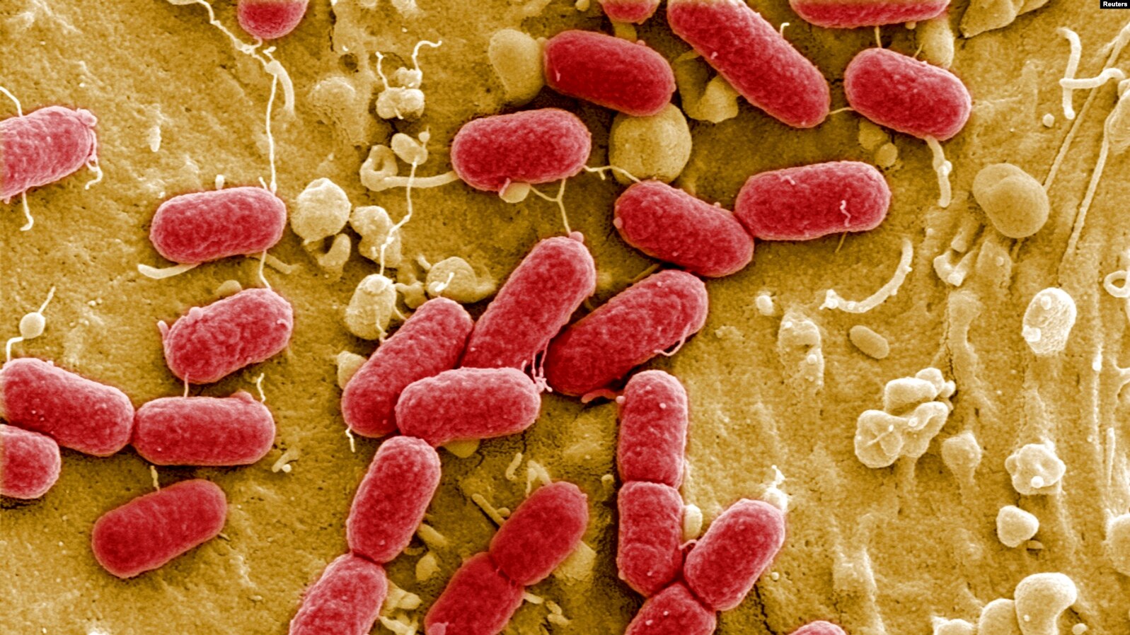 La “pandemia silenciosa”: bacterias resistentes a antibióticos