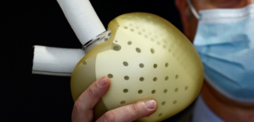 FRANCIA LIDERA LA REVOLUCIÓN BIOMÉDICA CON EL PRIMER CORAZÓN ARTIFICIAL TOTAL BIOCOMPATIBLE