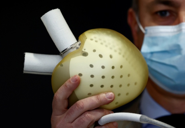 FRANCIA LIDERA LA REVOLUCIÓN BIOMÉDICA CON EL PRIMER CORAZÓN ARTIFICIAL TOTAL BIOCOMPATIBLE